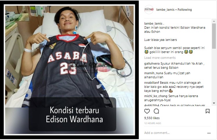 Foto Kondisi Edison