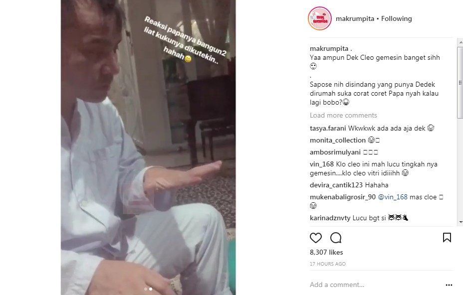 Reaksi Judika Saat Kuku Jarinya Penuh Kutek Warna Warni