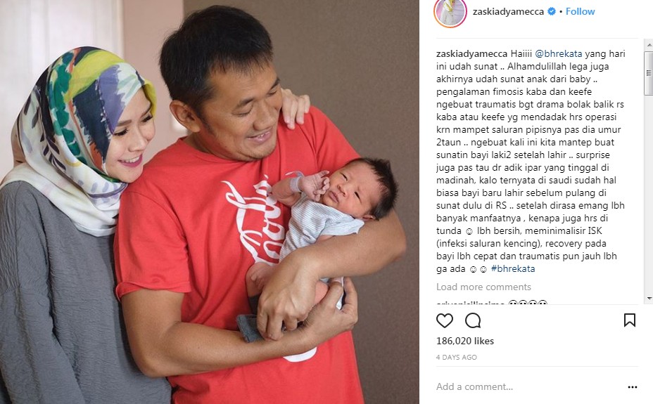 Baru Beberapa Hari, Anak Keempat Zaskia Adya Mecca dan Hanung Bramantyo Sudah Disunat