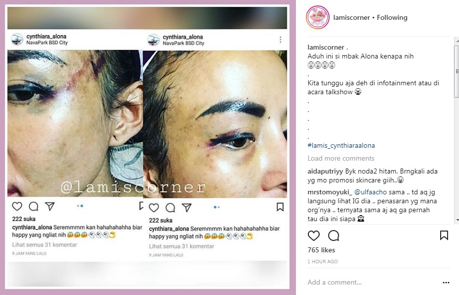 Wajah Cynthiara Alona dari Jarak Dekat