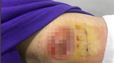 Luka Han Ye Seul menjadi korban malpraktek