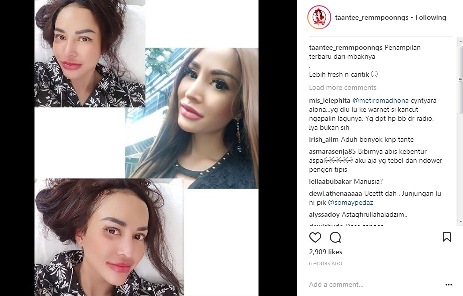 Wajah Cynthiara Alona Dinilai Berubah