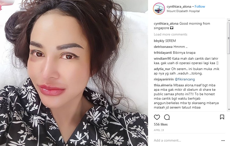 Cynthiara Alona Dirawat di Rumah Sakit Singapura