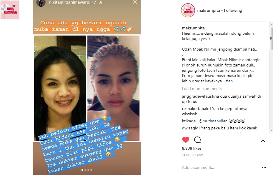 Foto Nikita Mirzani Sebelum Operasi Plastik