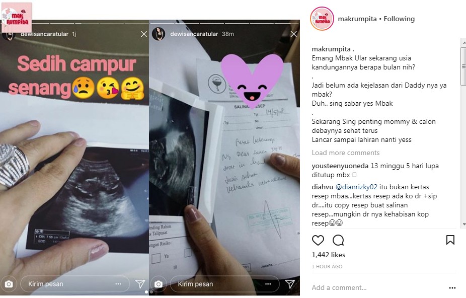 Hasil USG Dewi Sanca