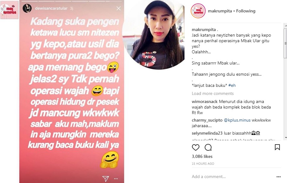 Dewi Sanca Ngaku Hanya Pernah Operasi Hidung