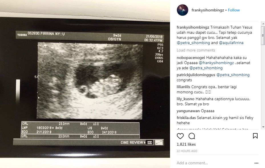 Foto USG Firrina Sinatrya