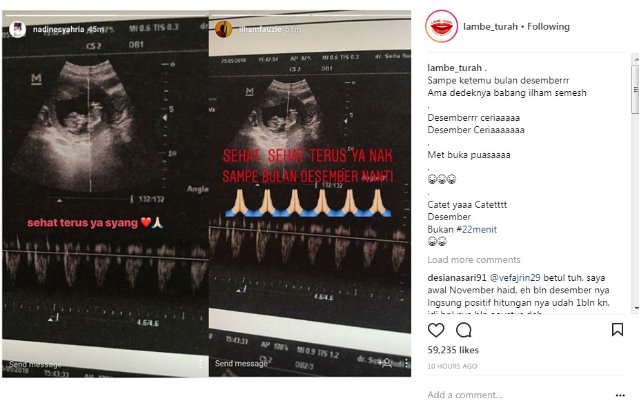 Ilham Fauzi dan Istri Kompak Tunjukkan Foto USG Anak