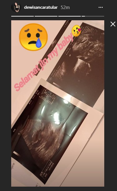 Kesedihan Dewi Sanca Pasca Keguguran