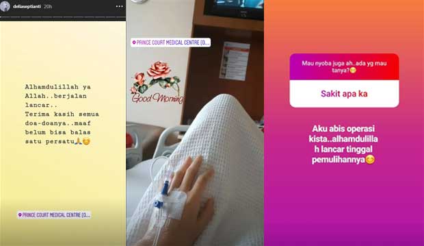 Delia Septianti Umumkan Kondisi Terbaru