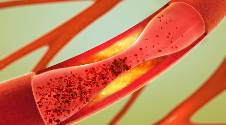 Foto: 8 Bahan Alami yang Mampu Menurunkan dan Menstabilkan Kolesterol