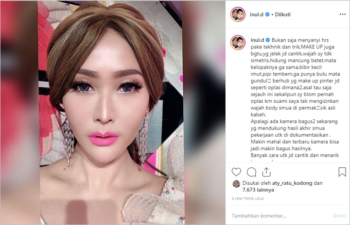 Akui Tak Pernah Operasi Plastik, Inul Daratista Bagi Tips Foto Tampak Cantik di Medsos