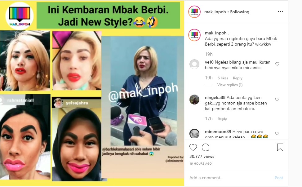 Bibir \'Jontor\' Jadi Tren, Barbie Kumalasari Justru Makin Tuai Cibiran Hingga Disebut Pembohong