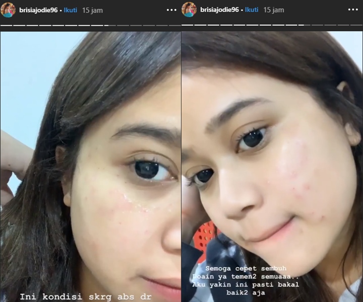 Wajah Mulus Jadi Rusak, Brisia Jodie Akui Ogah Kembali Datangi Klinik Kecantikan