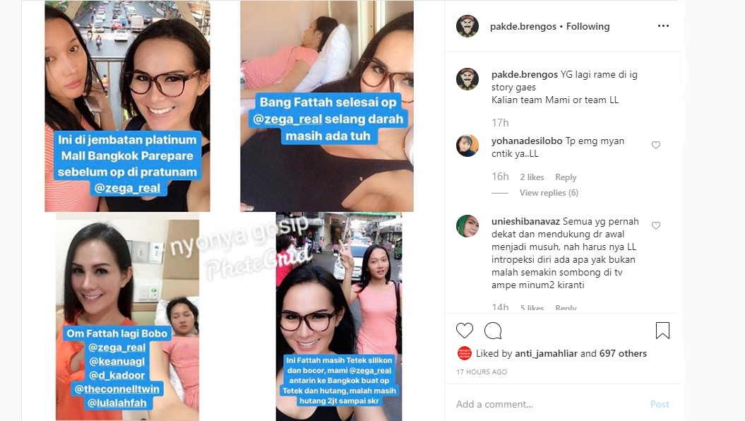 Beredar Foto Lucinta Luna Pertama Kali Oplas Payudara, Dukungan Kini Malah Didapat \'Rival\' Keanu