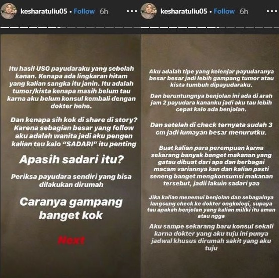 kesha-ratuliu-instastory