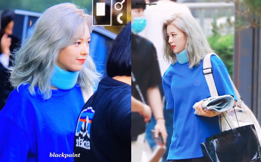 Tak Ada Fancam Individual Dirinya Dirilis, Jeongyeon Malah Ngaku Sedang Alami Cedera Leher