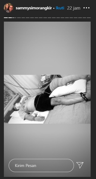 Kecelakaan Motor Hingga Patah Kaki, Istri Beber Kondisi Sammy Simorangkir Jelang Operasi