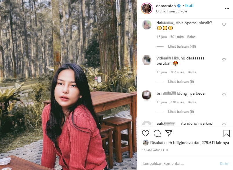 Dinyinyir Usai ‘Rombak’ Hidung, Selebgram Dara Arafah Sebut Kantongi Izin Orangtua Sejak SMP