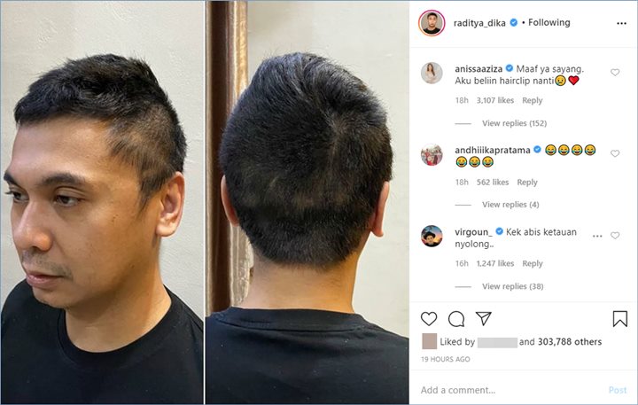 raditya dika menceritakan mengenai sang istri yang gagal memotong rambutnya