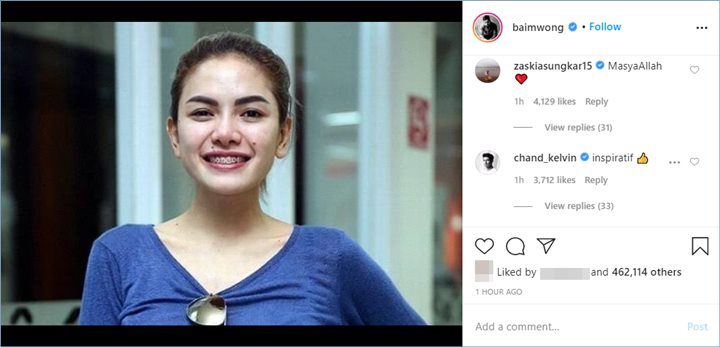 sederet selebriti ternama terlihat memberikan komentar di potret nikita mirzani yang dibagikan oleh baim wong