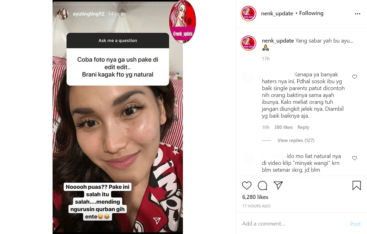Dicibir Karena Sering Edit Foto, Ayu Ting Ting Ngegas Sambil Buktikan Wajah Cantik Alami