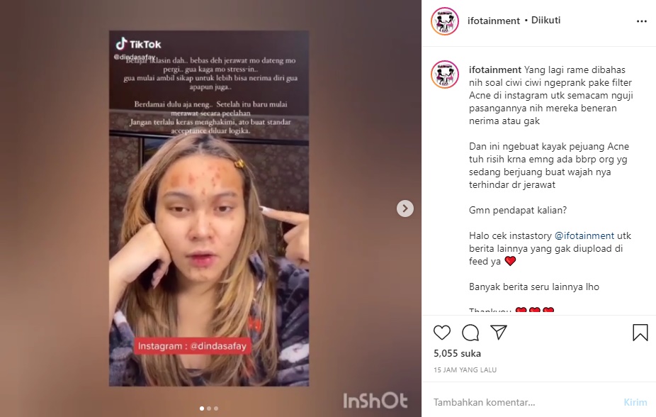 Biasa Dihujat, Selebgram Dinda Shafay Kini Panen Pendukung Saat Komentari ‘Acne Prank’