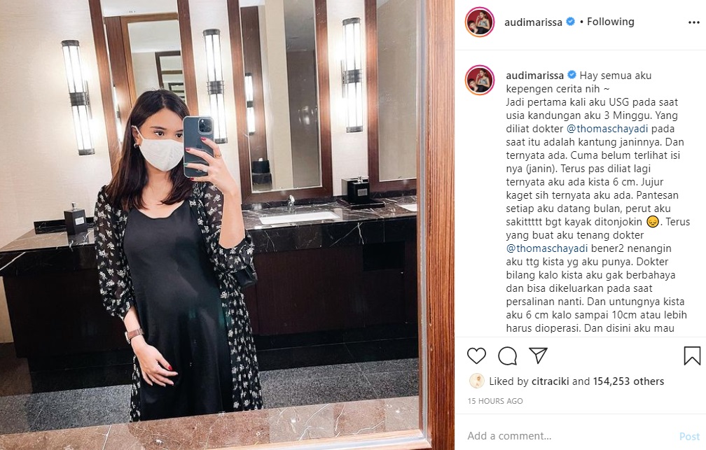 Tengah Hamil, Audi Marissa Ungkap Idap Kista dan Infeksi Saluran Kemih