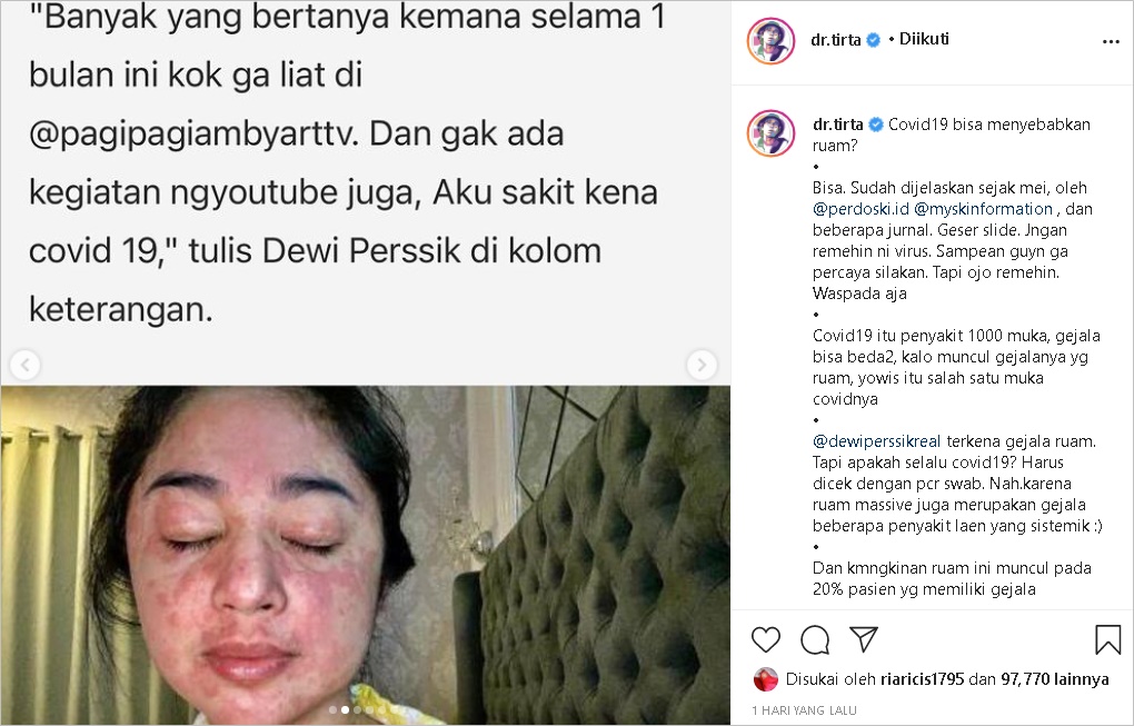 Wajah dan Tubuh Dewi Persik Alami Ruam Merah Saat Terpapar Covid-19, Begini Penjelasan dr. Tirta