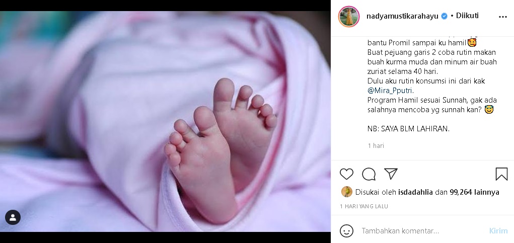 Unggah Foto Kaki Bayi Bikin Heboh, Nadya Mustika Istri Rizki DA Tegaskan Faktanya