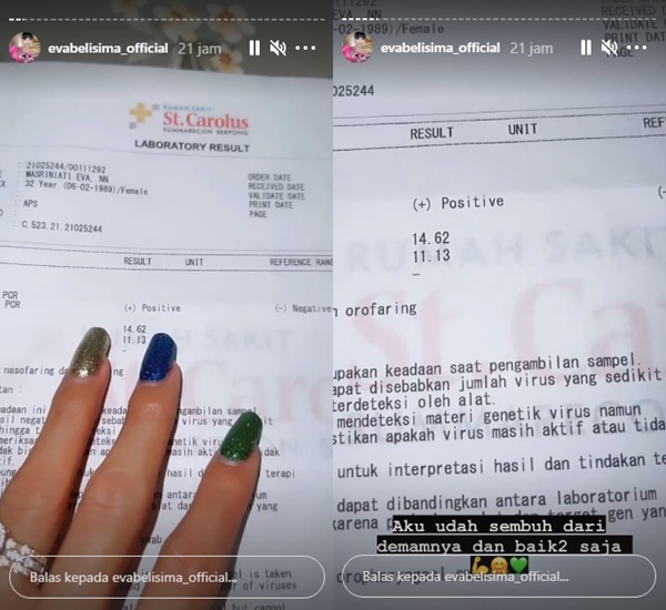 Eva Belisima Kabarkan Positif COVID-19 Bareng Sang Tunangan, Ungkap Sedih Karena Hal Ini