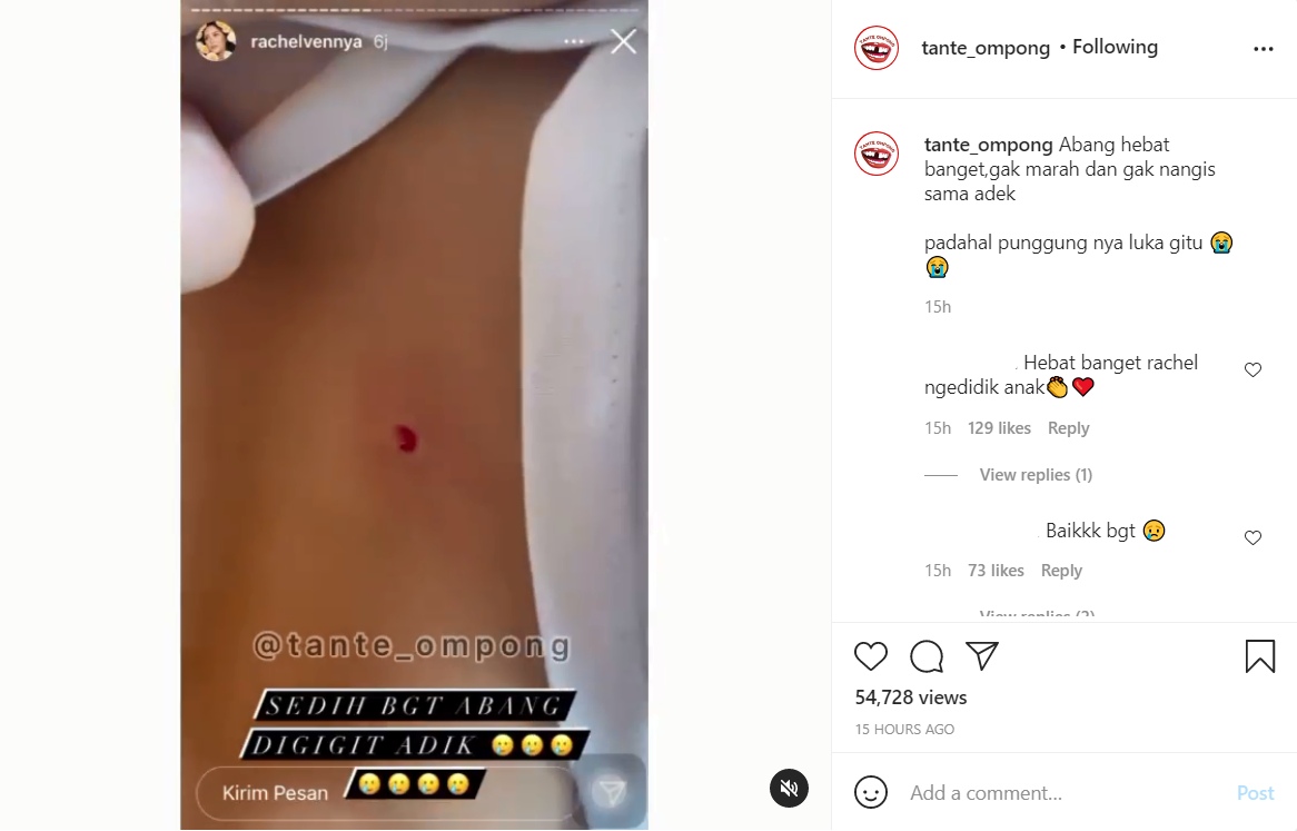 Xabiru Terluka Digigit Chava, Cara Rachel Vennya Buat Kedua Buah Hatinya Damai Tuai Pujian Selangit