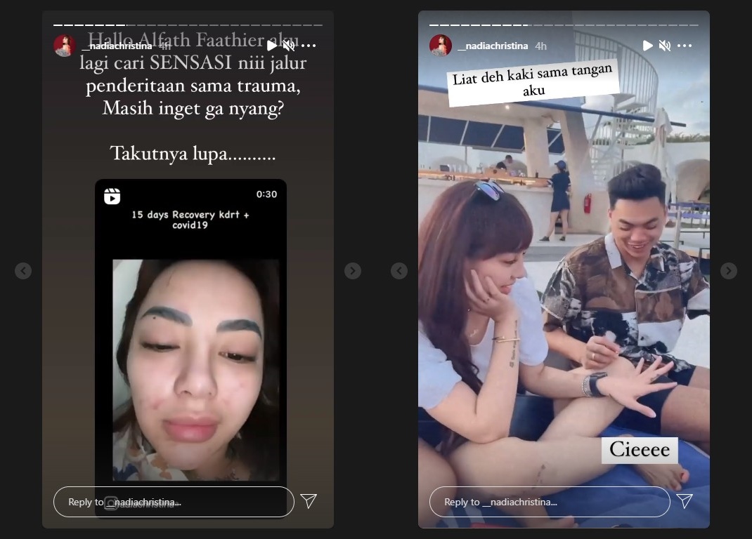 Nadia Christina Tunjukkan Badan Penuh Lebam, Alfath Fathier Kena Sentil