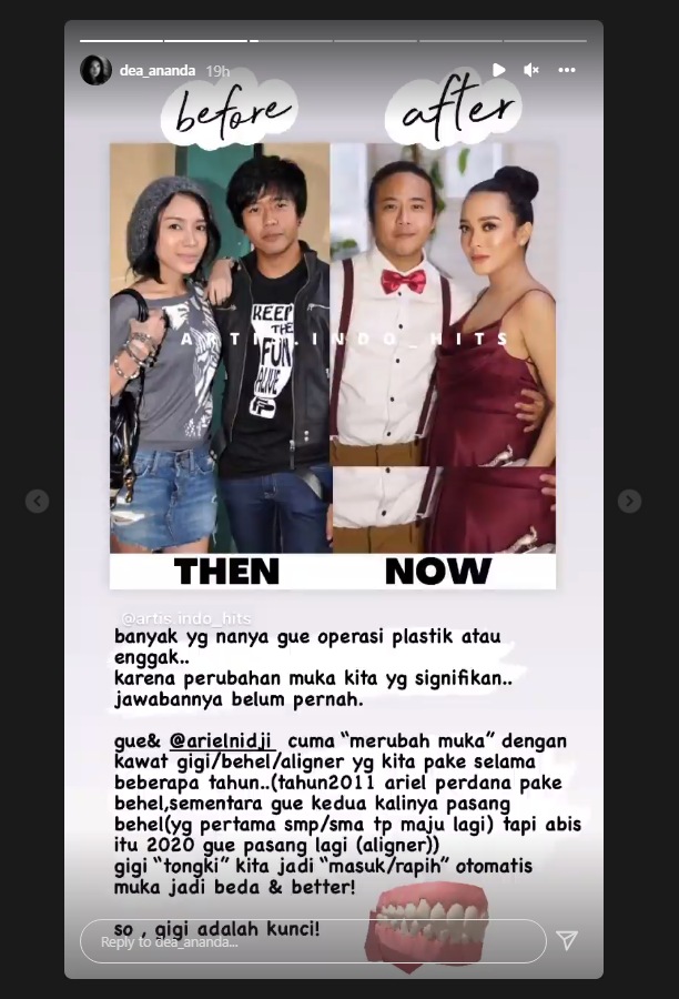 Dituding Operasi Plastik, Dea Ananda Ungkap Hanya \'Merubah Muka\' Ini