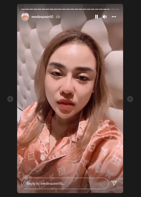 Medina Zein Pede Pamer Foto Tanpa Hijab, Disinggung Soal Masalah Kesehatan Mental